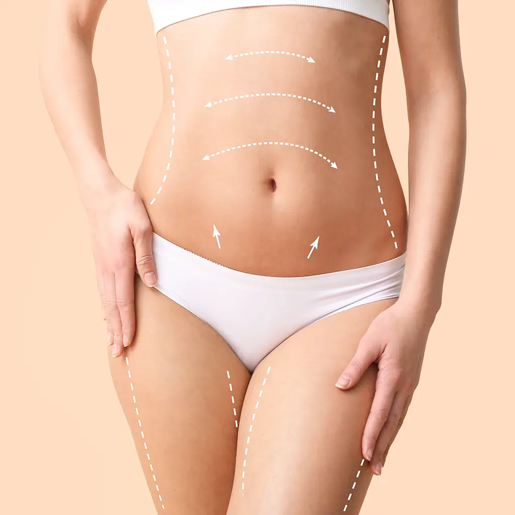 Liposuction 4 Beşiktaş karın germe ameliyatı